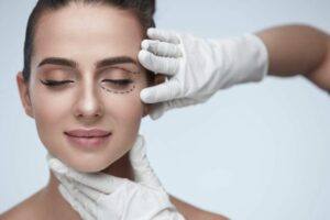 Preguntas y respuestas sobre Blefaroplastia