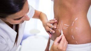 Por qué es importante el uso de fajas tras una liposucción o una abdominoplastia