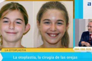 Los doctores Fernández hablan sobre la otoplastia en TPA