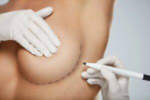 ¿Se puede dar el pecho tras una Cirugía Mamaria?