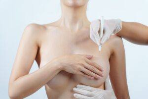Dudas frecuentes sobre la cirugía de elevación mamaria o mastopexia