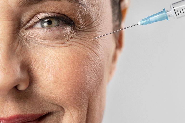 Botox para eliminar arrugas